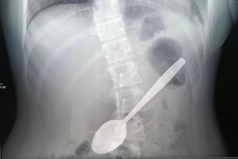 Foto